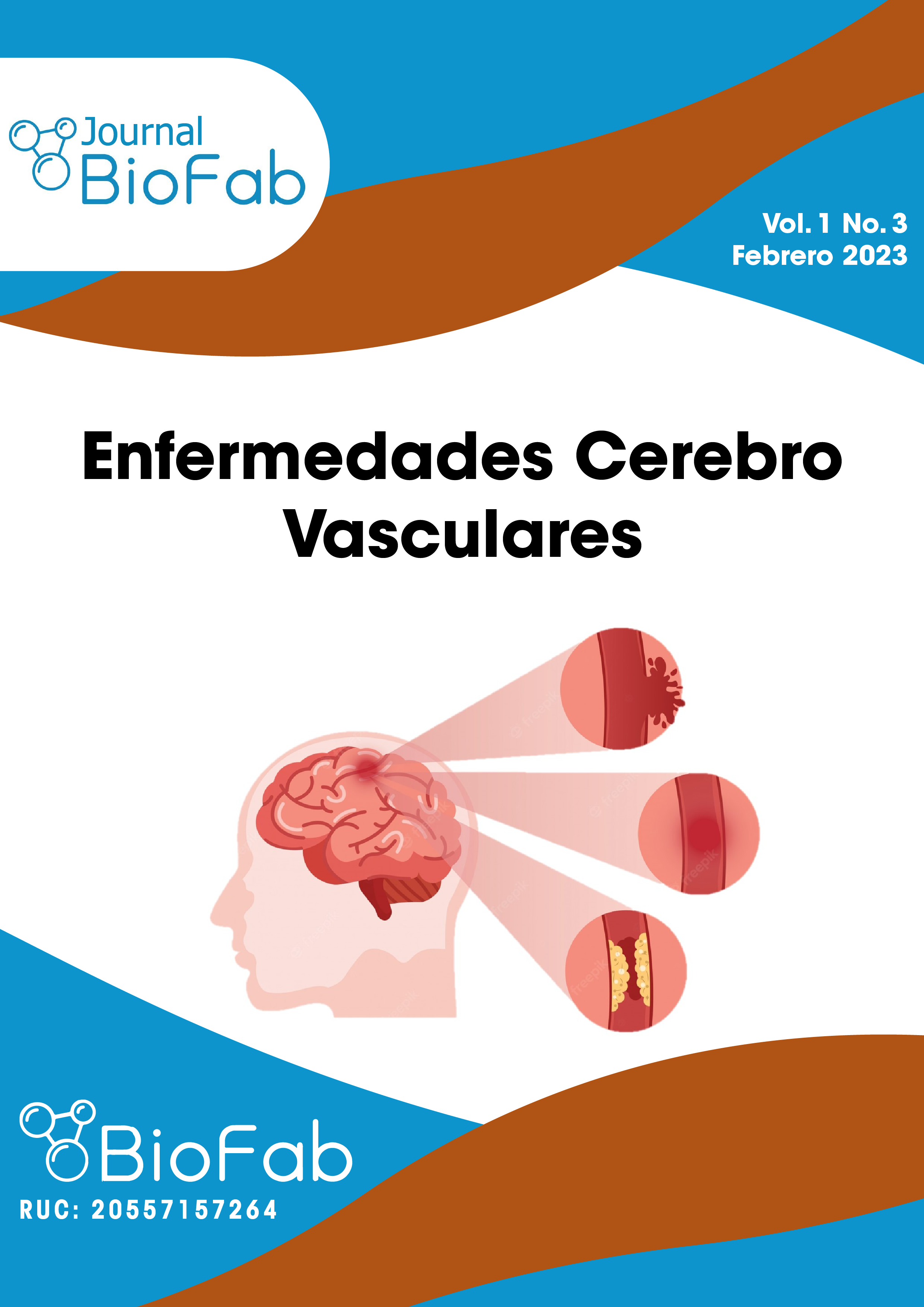 					Ver Vol. 1 Núm. 3 (2023): Enfermedades Cerebro Vasculares
				
